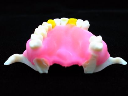 maxilla