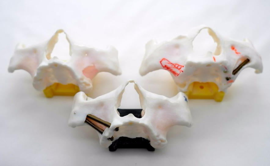 zygoma